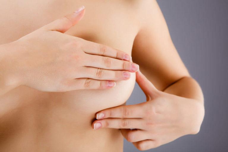 Breast Reduction Surgery and Insurance: What You Need to Know
