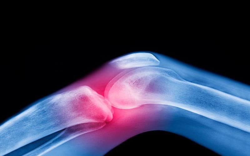 image 42 The Top 5 Knee Care Tablets for Active Lifestyles