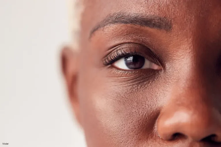 Eyelid Surgery for Droopy Eyes Transform Your Look