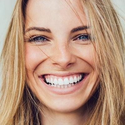 Zoom Teeth Whitening: Everything You Should Know Before Your Appointment