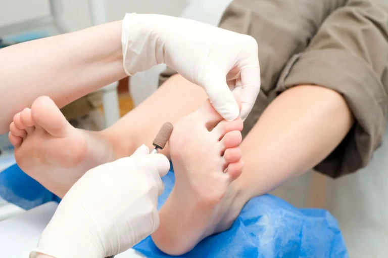 Achieve Healthy Feet at Any Age with Expert Footcare