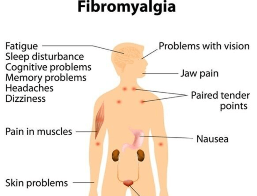 Screenshot 8 Ayurvedic treatment for fibromyalgia