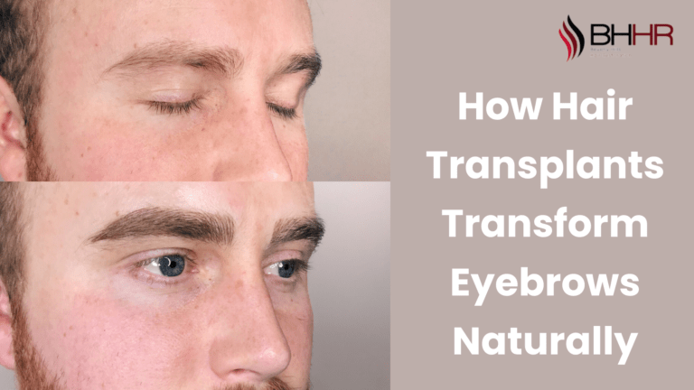 hair transplant for eyebrows