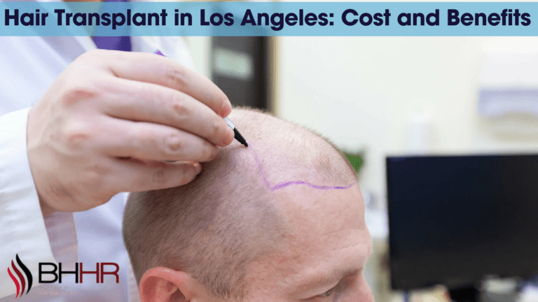 hair transplant cost los angeles