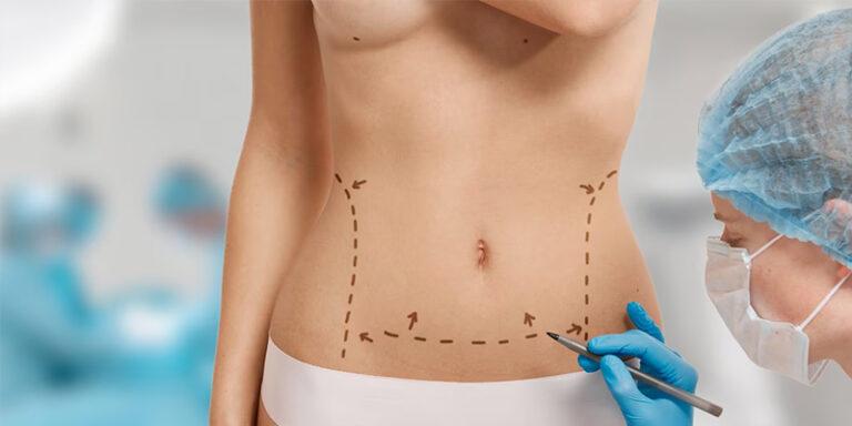 Achieve Your Dream Look with Tailored Cosmetic Surgery by Dr. Hiranmayi Jha in Delhi
