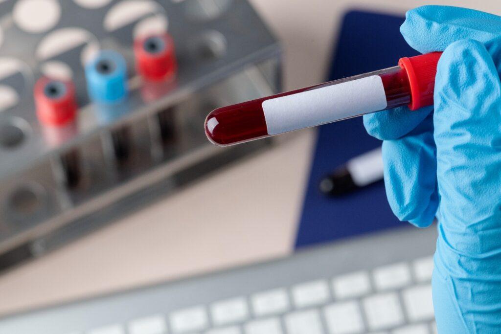 BloodTestHomeCollectioninPune4 1 Choose Blood Test at Home for Faster and Safer Diagnostics