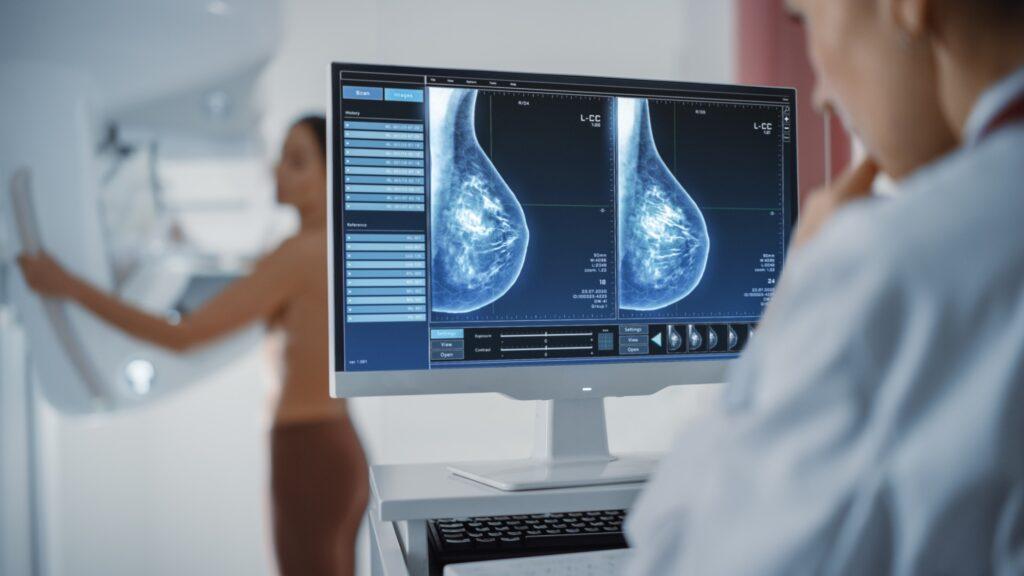 Breast Cancer Screening in Womens Health 3 The Crucial Role of Breast Cancer Screening in Women's Health