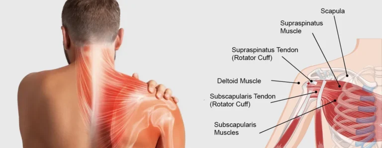 Shoulder Pain Diagnosis Chart