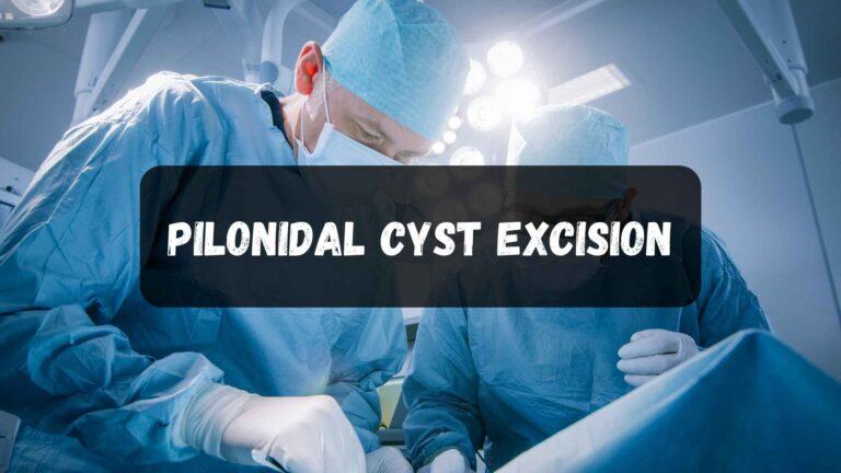 pilonidal cyst excision
