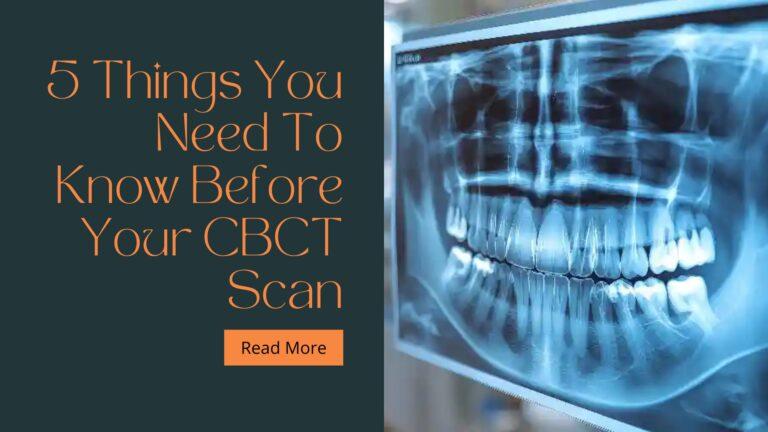 5 Things You Need To Know Before Your CBCT Scan