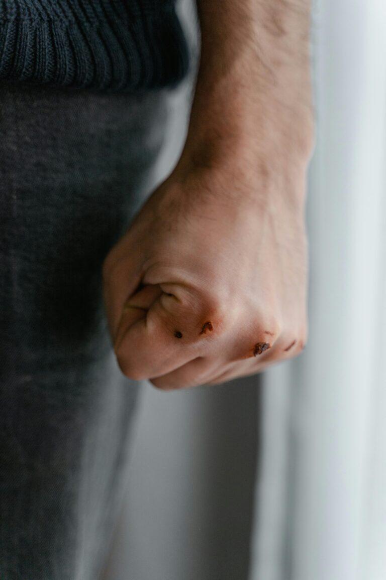 Complications of a Macerated Wound