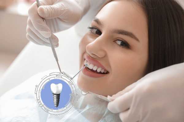 Dental Implants