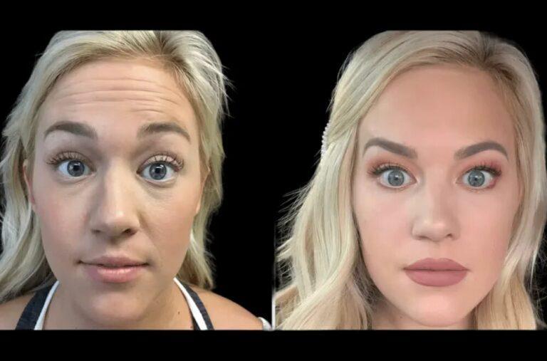 How the Best Plastic Surgeon in dubai Creates Custom Botox Plans for Every Face