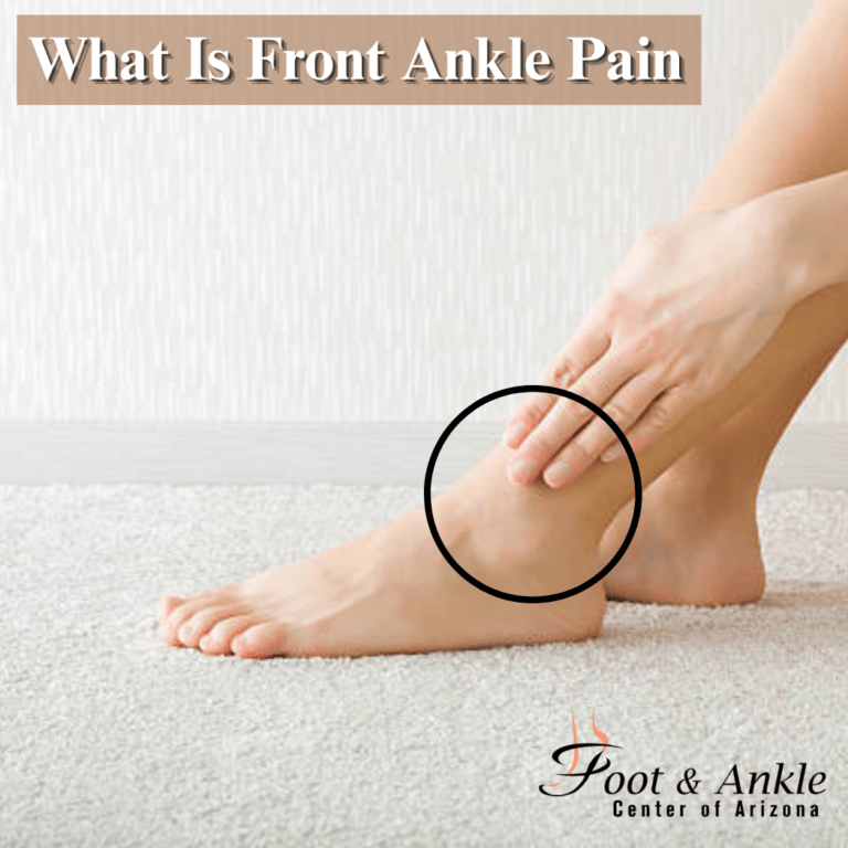 Front Ankle Pain