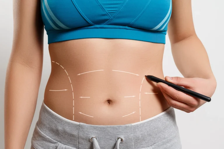 Liposuction in Dubai: Why Dubai Is Becoming a Top Destination for Liposuction