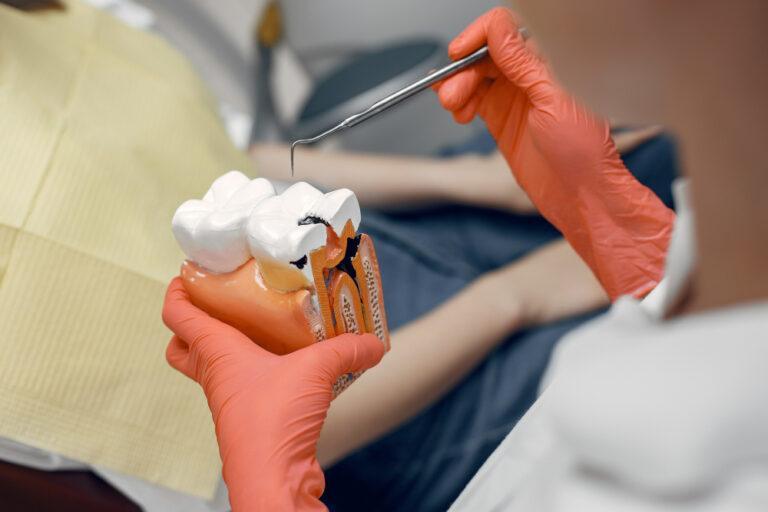 Root Canal in Medicine Hat