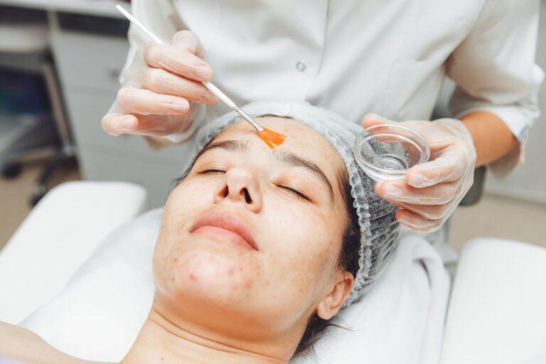 Chemical Peels Cost in Dubai