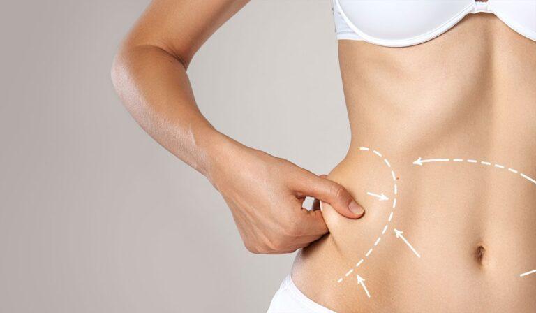 What to Expect During Recovery After Liposuction in Dubai