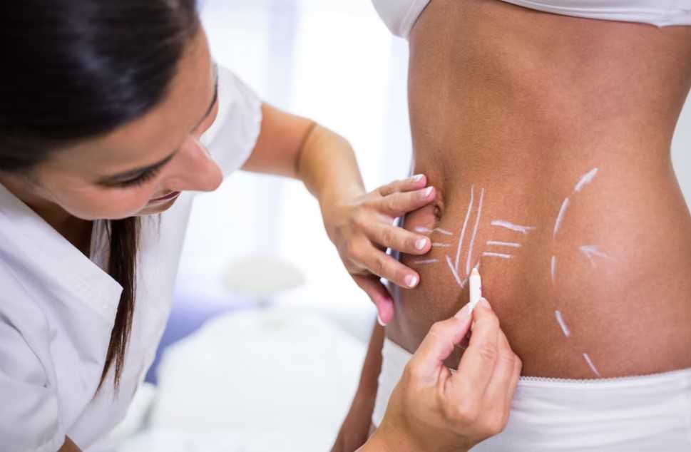 Liposuction in Islamabad Liposuction in Islamabad