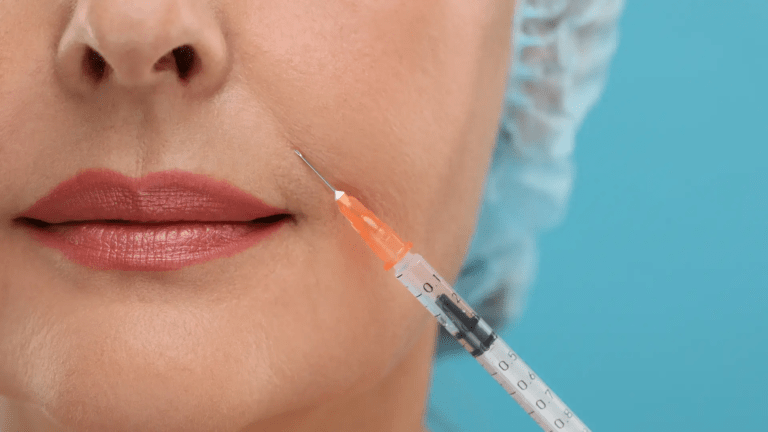 Best Lip Fillers Injections in Dubai