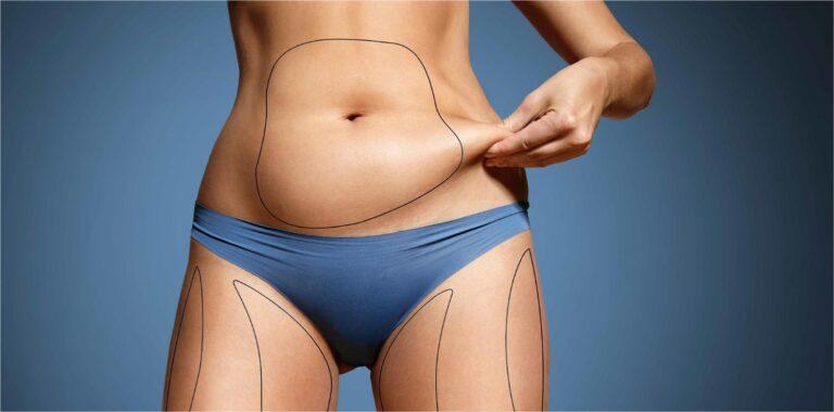 Abdominoplasty in Dubai: How to Prepare for a Flatter, More Toned Abdomen