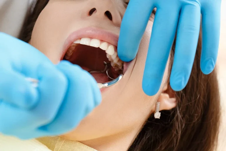Wisdom Teeth Removal in Nottingham